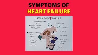 Symptoms of Heart Failure [upl. by Crissie833]