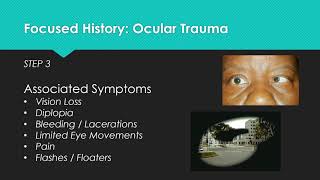 Assessing Eye Trauma [upl. by Ahsiner763]