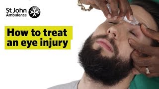 How to Treat An Eye Injury  First Aid Training  St John Ambulance [upl. by Queen]