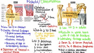 What is RicketsOsteomalacia [upl. by Aikal858]