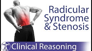 Lumbar Radicular Syndrome vs Intermittent Neurogenic ClaudicationStenosis [upl. by Nanette]