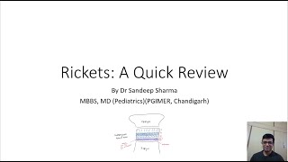 Rickets A Quick Review by Dr Sandeep Sharma [upl. by Thorpe]