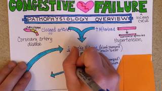 Congestive Heart Failure Pathophysiology [upl. by Tanitansy128]